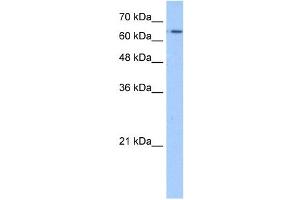 Western Blotting (WB) image for anti-Solute Carrier Family 22 (Organic Cation Transporter), Member 11 (SLC22A11) (N-Term) antibody (ABIN2781663)