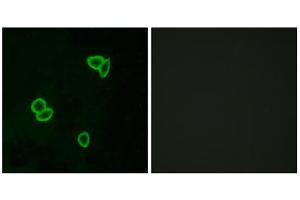 Immunofluorescence analysis of LOVO cells, using LPHN1 antibody. (Latrophilin 1 抗体  (Internal Region))