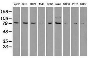 Image no. 6 for anti-B-Raf proto-oncogene, serine/threonine kinase (BRAF) antibody (ABIN1496954)