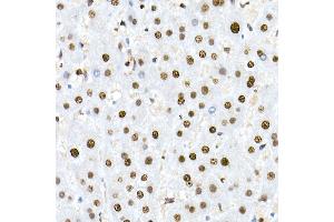 Immunohistochemistry of paraffin-embedded human liver using Nucleolin Rabbit mAb (ABIN7269035) at dilution of 1:25 (40x lens). (Nucleolin 抗体)