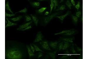 Immunofluorescence of monoclonal antibody to GFRA1 on HeLa cell. (GFRA1 抗体  (AA 32-119))