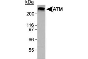 Western blot analysis of ATM in HeLa whole cell lysate using ATM polyclonal antibody . (ATM 抗体  (C-Term))