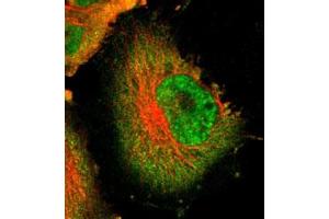 Immunofluorescent staining of U-251 MG with USP5 polyclonal antibody  (Green) shows positivity in cytoplasm and nucleus but excluded from the nucleoli. (USP5 抗体)