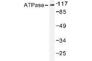 Western blot (WB) analysis of Na+/K+ ATPase alpha-1 antibody in extracts from 293 PMA 125ng/ml 30' cells. (ATP1A1 抗体)