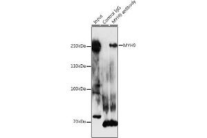 Immunoprecipitation analysis of 300 μg extracts of HeLa cells using 3 μg MYH9 antibody (ABIN1513234, ABIN3020656, ABIN3020657 and ABIN6213646). (Myosin 9 抗体  (AA 1711-1960))