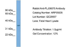 WB Suggested Anti-FLJ36070  Antibody Titration: 0. (FLJ36070 (N-Term) 抗体)