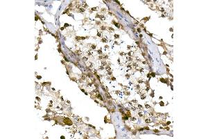Immunohistochemistry of paraffin-embedded human testis using TET1 Rabbit mAb (ABIN7270777) at dilution of 1:100 (40x lens).