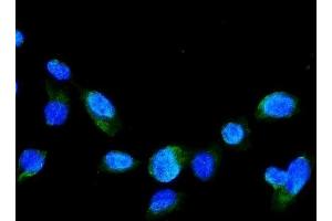 IF analysis of GRK2 using anti-GRK2 antibody (ABIN5693069). (GRK2 抗体)