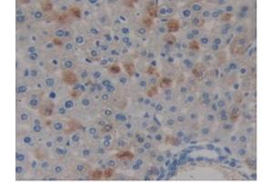 IHC-P analysis of Mouse Liver Tissue, with DAB staining. (COMP 抗体  (AA 554-753))