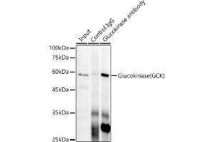 Immunoprecipitation analysis of 300 μg extracts of HeLa cells using 3 μg Glucokinase (GCK) antibody (ABIN7267396). (GCK 抗体)