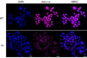 Immunocytochemical staining of Hela cells using RAD23A antibody (ABIN7800116), 1:1,000), Top panel: wild-type (WT), Bottom panal: RAD23A shRNA knockdown (KD).