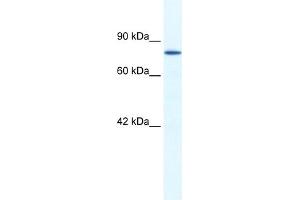 WB Suggested Anti-ZNF214 Antibody Titration:  1. (ZNF214 抗体  (N-Term))