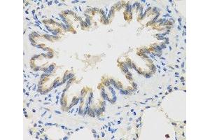 Immunohistochemistry of paraffin-embedded Rat lung using TICAM1 Polyclonal Antibody at dilution of 1:100 (40x lens). (TICAM1 抗体)