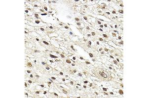 Immunohistochemistry (IHC) image for anti-Nuclear Receptor Subfamily 3, Group C, Member 1 (Glucocorticoid Receptor) (NR3C1) (AA 1-280) antibody (ABIN3023091)
