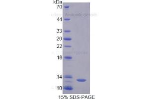 SDS-PAGE of Protein Standard from the Kit (Highly purified E. (DAO ELISA 试剂盒)