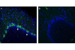Expression of NMUR1 in rat cerebellum. (NMUR1 抗体  (Extracellular))