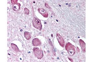 Anti-GABRA3 antibody IHC of human brain, basal nucleus of Meynert. (GABRA3 抗体  (N-Term))