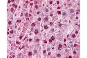 Immunohistochemistry (IHC) image for anti-Hepatocyte Nuclear Factor 4, alpha (HNF4A) (Middle Region) antibody (ABIN2779763) (HNF4A 抗体  (Middle Region))