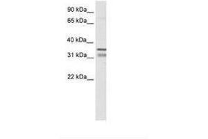 Image no. 1 for anti-NK2 Homeobox 2 (Nkx2-2) (AA 30-79) antibody (ABIN6736071) (Nkx2-2 抗体  (AA 30-79))