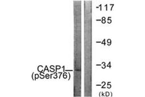 Western blot analysis of extracts from 293 cells, using Caspase 1 (Phospho-Ser376) Antibody. (Caspase 1 抗体  (pSer376))