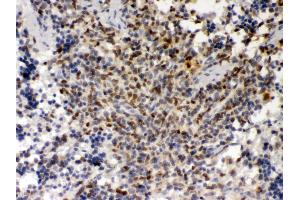 Immunohistochemistry (IHC) image for anti-Spleen Focus Forming Virus (SFFV) Proviral Integration Oncogene Spi1 (SPI1) (AA 18-196) antibody (ABIN3043440)