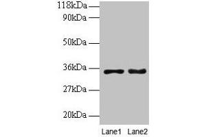 Western blot All lanes: PTDSS1 antibody at 2 μg/mL Lane 1: EC109 whole cell lysate Lane 2: 293T whole cell lysate Secondary Goat polyclonal to rabbit IgG at 1/15000 dilution Predicted band size: 56, 39, 35 kDa Observed band size: 35 kDa (PTDSS1 抗体  (AA 1-35))