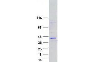 Western Blotting (WB) image for Complement Factor H-Related 3 (CFHR3) (Transcript Variant 2) protein (Myc-DYKDDDDK Tag) (ABIN2712459)