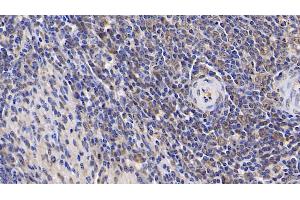 Detection of IL17RA in Human Spleen Tissue using Polyclonal Antibody to Interleukin 17 Receptor A (IL17RA) (IL17RA 抗体  (AA 33-172))
