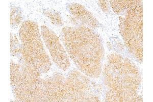 Immunohistochemistry (IHC) image for anti-Tubulin, beta (TUBB) (AA 1-50) antibody (ABIN7453995)