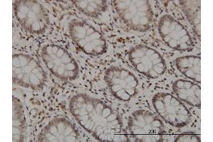 Immunostaining (ISt) image for anti-Glucocorticoid Modulatory Element Binding Protein 1 (GMEB1) (AA 467-563) antibody (ABIN564661)