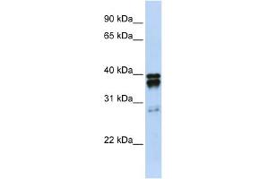 WB Suggested Anti-NUDT18 Antibody Titration:  0. (NUDT18 抗体  (N-Term))