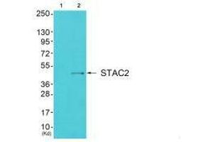 Western blot analysis of extracts from cos-7 cells (Lane 2), using STAC2 antiobdy. (STAC2 抗体)