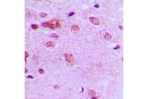 Immunohistochemical analysis of c-FER staining in human brain formalin fixed paraffin embedded tissue section. (FER 抗体  (C-Term))