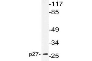 Western blot (WB) analysis of p27 antibody in extracts from NIH/3T3cells. (CDKN1B 抗体)