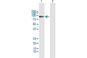 Western Blot analysis of CALD1 expression in transfected 293T cell line by CALD1 MaxPab polyclonal antibody. (Caldesmon 抗体  (AA 1-538))