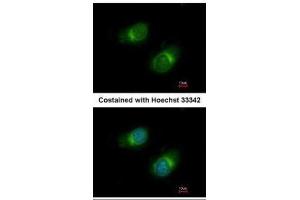 Immunofluorescence (IF) image for anti-Collagen, Type III, alpha 1 (COL3A1) (C-Term) antibody (ABIN2856819)