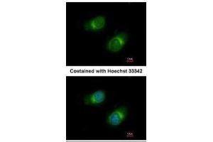 ICC/IF Image Immunofluorescence analysis of methanol-fixed HeLa, using COL3A1, antibody at 1:50 dilution. (COL3A1 抗体  (C-Term))
