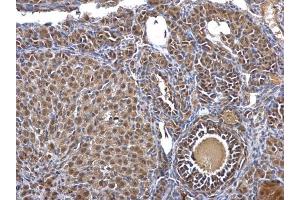 IHC-P Image Casein Kinase 2 beta antibody detects Casein Kinase 2 beta protein at nucleus and cytosol on mouse ovary by immunohistochemical analysis.