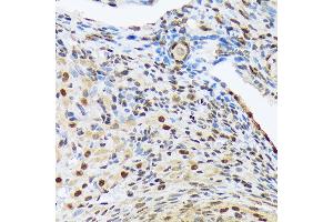 Immunohistochemistry of paraffin-embedded rat ovary using HES5 Rabbit mAb (ABIN7267559) at dilution of 1:100 (40x lens). (HES5 抗体)