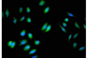 Immunofluorescent analysis of A549 cells using ABIN7145784 at dilution of 1:100 and Alexa Fluor 488-congugated AffiniPure Goat Anti-Rabbit IgG(H+L) (BIN3 抗体  (AA 8-240))