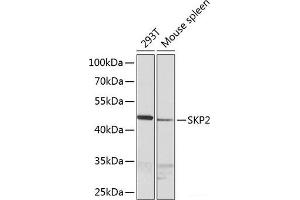 Western blot analysis of extracts of various cell lines using SKP2 Polyclonal Antibody at dilution of 1:1000. (SKP2 抗体)
