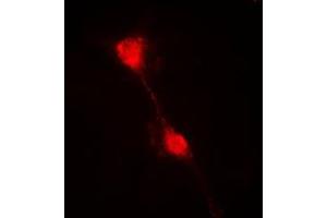 Immunofluorescent analysis of IKB alpha staining in HepG2 cells. (NFKBIA 抗体  (N-Term))