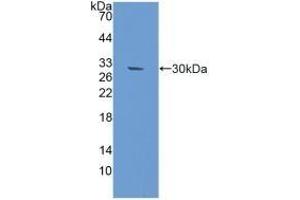 Detection of Recombinant RAD50, Mouse using Polyclonal Antibody to DNA Repair Protein RAD50 (RAD50) (RAD50 抗体  (AA 1-234))