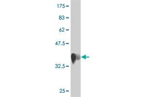 Western Blot detection against Immunogen (36. (RNFT1 抗体  (AA 1-100))