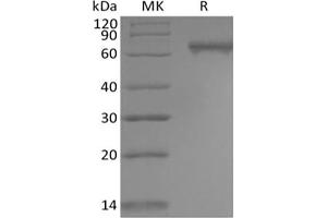 Western Blotting (WB) image for Notch 2 (NOTCH2) protein (His tag) (ABIN7319906) (NOTCH2 Protein (His tag))