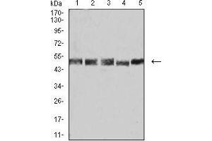 Western Blotting (WB) image for anti-Ubiquitin Fusion Degradation Protein 1 Homolog (UFD1L) (AA 208-307) antibody (ABIN5542401)