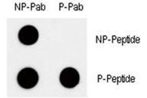 Dot blot analysis of phospho c-Myc antibody. (c-MYC 抗体  (pThr58))