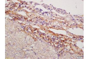 Immunohistochemistry (Paraffin-embedded Sections) (IHC (p)) image for anti-NFAT Activating Protein with ITAM Motif 1 (NFAM1) (AA 81-180) antibody (ABIN749033)