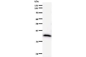 Western Blotting (WB) image for anti-DEAD (Asp-Glu-Ala-Asp) Box Polypeptide 5 (DDX5) antibody (ABIN933122) (DDX5 抗体)