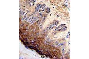 Formalin-fixed and paraffin-embedded human skin with TOP2A Antibody (C-term), which was peroxidase-conjugated to the secondary antibody, followed by DAB staining. (Topoisomerase II alpha 抗体  (C-Term))